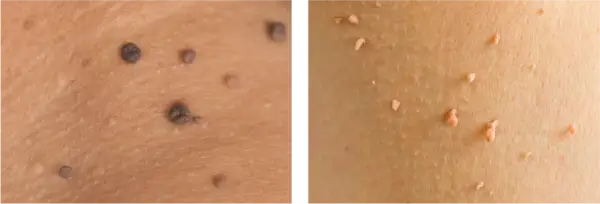 Bőrcímkék különböző bőrtónusokon