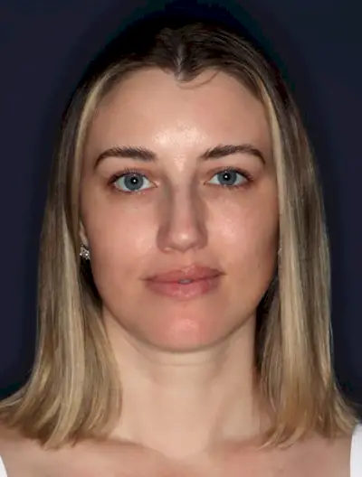 Bilden kan innehålla Huvudperson Ansikte Fotografi Porträtt Kroppsdel Hals Blont hår Vuxen och hud