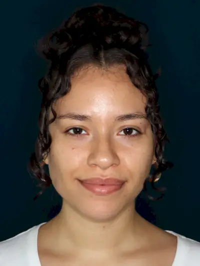 Ivette SelfGrowth Grup Çekimi
