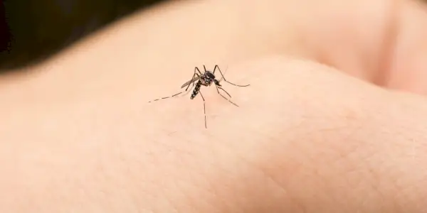 Doktora Göre Bunlar Sivrisinek Isırığı Alerjisinin Belirtileri