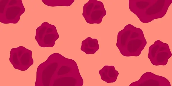 Vas skrbijo menstrualni strdki? Kdaj obiskati zdravnika