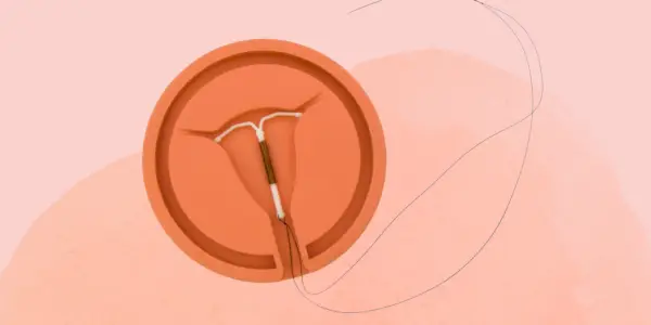 Her er hva du kan forvente etter fjerning av spiral, ifølge Ob-Gyns