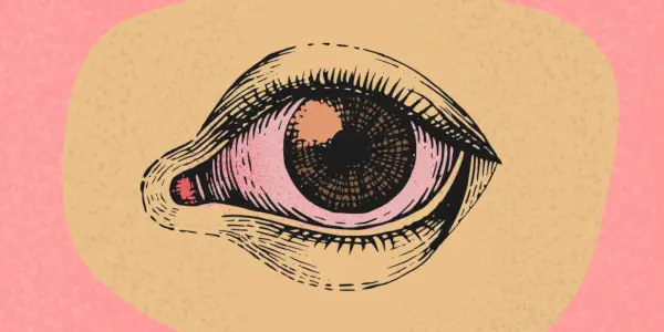 Dakle, imate sjeme u oku. Evo što učiniti