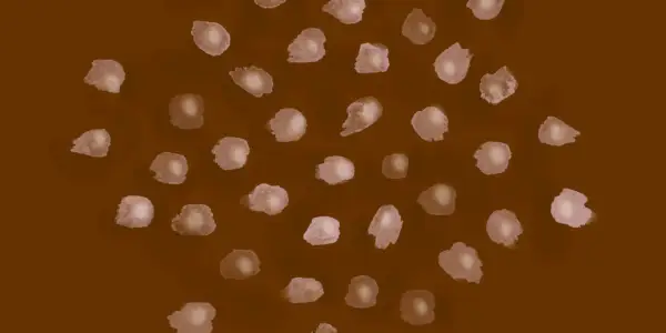 Aquí se explica cómo deshacerse del sarpullido por calor, según los dermatólogos