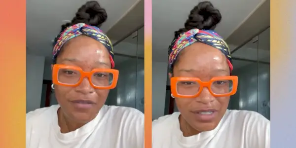 Keke Palmer szeretne valakit, aki már gyógyítaná a felnőttkori pattanásokat