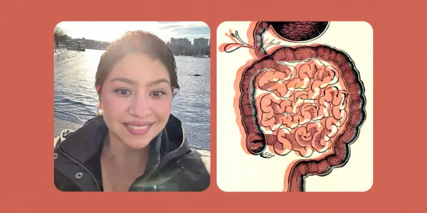 Mi è stato diagnosticato un cancro al colon a 32 anni. Ecco i primi sintomi che ho avuto