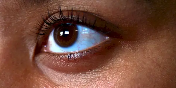 Tout ce que vous devez savoir sur le comblement sous les yeux