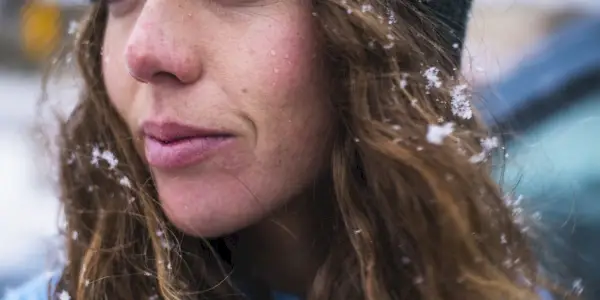 Hoe u windverbranding op uw gezicht kunt behandelen na een koude, winterse buitentraining