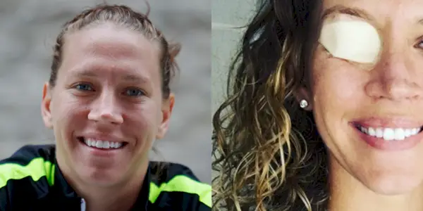 Lauren Holiday delte sin første selfie efter en hjernetumoroperation