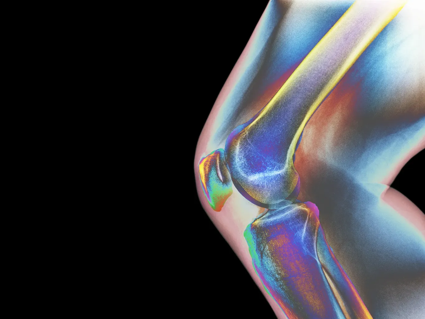 5 ting, du kan gøre nu for at forhindre osteoporose i fremtiden