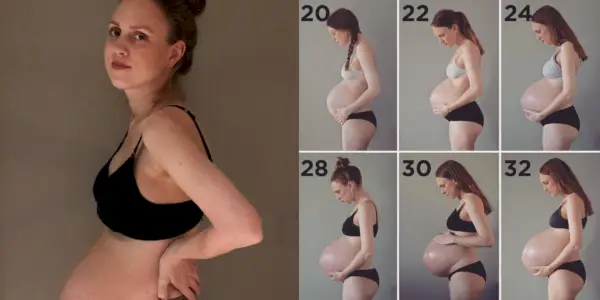 Nach der Geburt von Drillingen veröffentlichte diese Frau ein wirklich ehrliches Postpartum-Bauchfoto